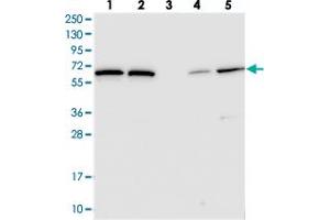Western blot analysis of Lane 1: RT-4, Lane 2: U-251 MG, Lane 3: Human Plasma, Lane 4: Liver, Lane 5: Tonsil with POLR3E polyclonal antibody  at 1:250-1:500 dilution. (POLR3E Antikörper)