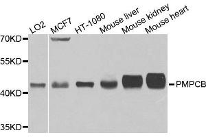 Western blot analysis of extracts of various cells, using PMPCB antibody. (PMPCB Antikörper)