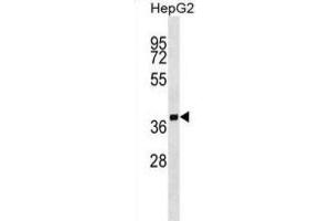 Western Blotting (WB) image for anti-Secretory Carrier Membrane Protein 2 (SCAMP2) antibody (ABIN2999377) (SCAMP2 Antikörper)