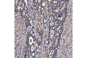 IHC analysis of SNRPA1 using anti-SNRPA1 antibody (ABIN7599131). (SNRPA1 Antikörper  (AA 1-233))