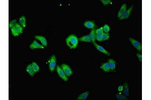 Immunofluorescent analysis of HepG2 cells using ABIN7159887 at dilution of 1:100 and Alexa Fluor 488-congugated AffiniPure Goat Anti-Rabbit IgG(H+L) (TIMM1B (AA 1-103) Antikörper)