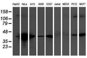 Image no. 2 for anti-Tropomodulin 1 (TMOD1) antibody (ABIN1501528)