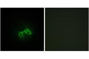 Immunofluorescence (IF) image for anti-Bladder Cancer Associated Protein (BLCAP) (AA 38-87) antibody (ABIN2889532) (BLCAP Antikörper  (AA 38-87))