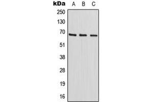 Western blot analysis of HIC2 expression in HepG2 (A), HeLa (B), NIH3T3 (C) whole cell lysates. (HIC2 Antikörper  (Center))
