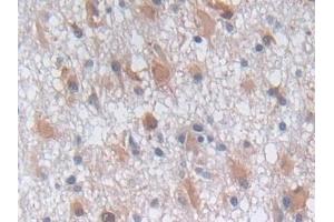 Immunohistochemistry (IHC) image for anti-Phosphoglycerate Kinase 1 (PGK1) (AA 2-417) antibody (ABIN7436240)