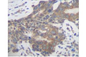 Image no. 2 for anti-Placenta Growth Factor (PGF) antibody (ABIN181639) (PLGF Antikörper)