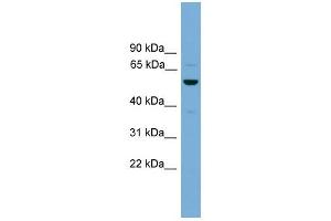ASZ1 antibody used at 1 ug/ml to detect target protein. (ASZ1 Antikörper  (Middle Region))