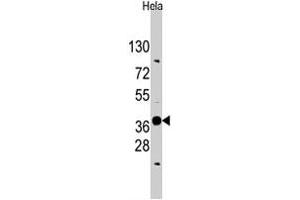 Western blot analysis of EDA polyclonal antibody  in HeLa cell lysate (35 ug/lane).