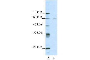 WB Suggested Anti-ARID3A  Antibody Titration: 0. (ARID3A Antikörper  (Middle Region))