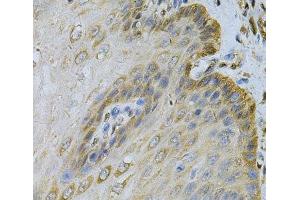 Immunohistochemistry of paraffin-embedded Human esophagus using PGK1 Polyclonal Antibody at dilution of 1:100 (40x lens). (PGK1 Antikörper)
