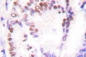 Image no. 1 for anti-Histone Deacetylase 9 (HDAC9) antibody (ABIN265461) (HDAC9 Antikörper)