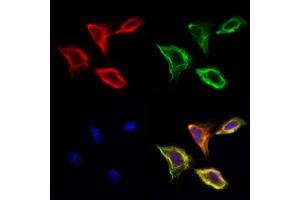 ABIN6260581 and ABIN6277918 staining Hela cells by IF/ICC. (CD166 Antikörper  (N-Term))