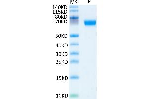 Hemopexin Protein (HPX) (AA 24-460) (His tag)