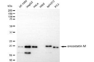 anti-Oncostatin M (OSM) antibody