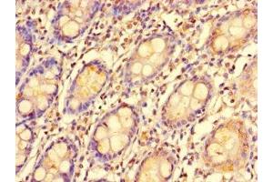 Immunohistochemistry of paraffin-embedded human colon tissue using ABIN7151974 at dilution of 1:100 (EDEM2 Antikörper  (AA 22-300))