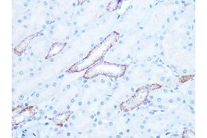 Immunohistochemistry of paraffin-embedded rat kidney using IR Rabbit mAb (ABIN7268009) at dilution of 1:100 (40x lens). (IRAK2 Antikörper)