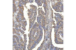 IHC analysis of TXNDC5 using anti-TXNDC5 antibody (ABIN7599699).