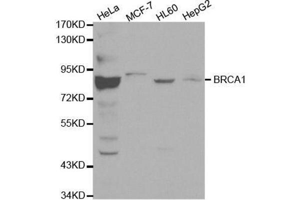 BRCA1 抗体  (AA 120-220)