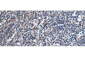 Immunohistochemistry of paraffin-embedded Human tonsil tissue using TNFSF18 Polyclonal Antibody at dilution of 1:45(x200)