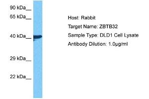 Host: Rabbit Target Name: ZBTB32 Sample Tissue: Human DLD1 Whole Cell Antibody Dilution: 1ug/ml (ZBTB32 Antikörper  (N-Term))