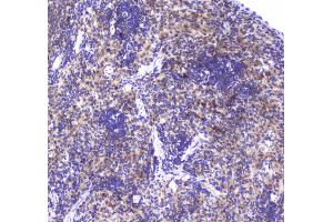 Immunohistochemistry (IHC) image for anti-Glyoxalase I (GLO1) (AA 2-184) antibody (ABIN5692862)