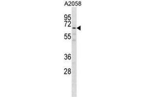 GPKOW Antibody (Center) western blot analysis in A2058 cell line lysates (35µg/lane). (GPKOW Antikörper  (Middle Region))