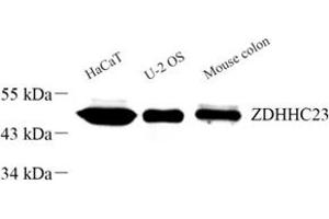 Western blot analysis of ZDHHC23 (ABIN7076281) at dilution of 1: 300 (ZDHHC23 Antikörper)