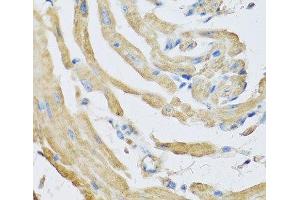 Immunohistochemistry of paraffin-embedded Mouse heart using SFRP4 Polyclonal Antibody at dilution of 1:100 (40x lens). (SFRP4 Antikörper)