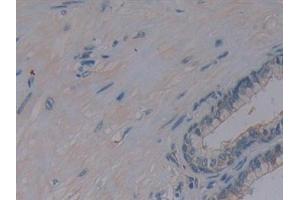 Detection of AMPK Alpha 1 in Human Prostate Tissue using Polyclonal Antibody to Protein Kinase, AMP Activated Alpha 1 (AMPK Alpha 1) (PRKAA1 Antikörper  (AA 28-257))
