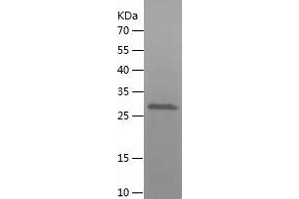 Caspase 3 Protein (CASP3) (AA 29-277) (His-IF2DI Tag)