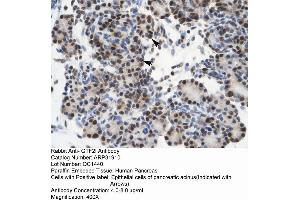 Rabbit Anti-GTF21 Antibody  Paraffin Embedded Tissue: Human Pancreas Cellular Data: Epithelial cells of pancreatic acinus Antibody Concentration: 4. (GTF2I Antikörper  (N-Term))
