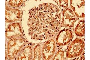 IHC image of ABIN7173825 diluted at 1:400 and staining in paraffin-embedded human kidney tissue performed on a Leica BondTM system. (TNFRSF1A Antikörper  (AA 263-468))