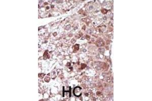 Immunohistochemistry (IHC) image for anti-phosphoenolpyruvate Carboxykinase 1 (Soluble) (PCK1) antibody (ABIN3003679) (PCK1 Antikörper)