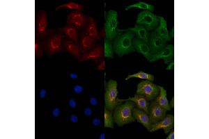 ABIN6263085 and ABIN6279557 staining Hela cells by IF/ICC.