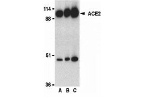 Western Blotting (WB) image for anti-Angiotensin I Converting Enzyme 2 (ACE2) (C-Term) antibody (ABIN1030215) (ACE2 Antikörper  (C-Term))