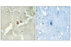 Immunohistochemistry analysis of paraffin-embedded human brain tissue using NSG2 antibody. (NSG2 Antikörper)