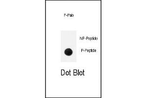 Dot Blot (DB) image for anti-Neurotrophic Tyrosine Kinase, Receptor, Type 1 (NTRK1) (pTyr791) antibody (ABIN389679)