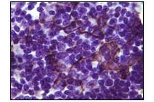 Immunohistochemistry (IHC) image for anti-B Lymphoid Tyrosine Kinase (BLK) (truncated) antibody (ABIN2464016) (BLK Antikörper  (truncated))