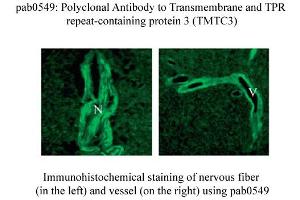 Image no. 1 for anti-Transmembrane and Tetratricopeptide Repeat Containing 3 (TMTC3) (C-Term) antibody (ABIN347751) (TMTC3 Antikörper  (C-Term))