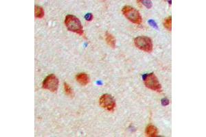 Immunohistochemical analysis of Aurora A (pT288) staining in human brain formalin fixed paraffin embedded tissue section. (Aurora A Antikörper  (pSer288))