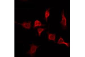 ABIN6276078 staining MCF7 by IF/ICC. (OR2T11 Antikörper  (Internal Region))