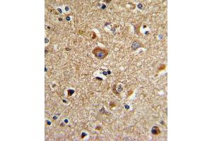 Formalin-fixed and paraffin-embedded human brain tissue with CD81 Antibody (C-term), which was peroxidase-conjugated to the secondary antibody, followed by DAB staining. (CD81 Antikörper  (C-Term))