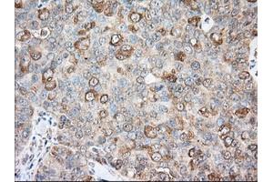 Immunohistochemical staining of paraffin-embedded Human liver tissue using anti-BCL10 mouse monoclonal antibody. (BCL10 Antikörper)