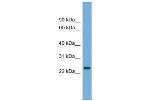C19orf18 antibody used at 1 ug/ml to detect target protein. (C19orf18 Antikörper  (N-Term))
