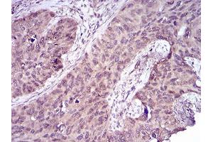 Immunohistochemistry (IHC) image for anti-Caspase 7, Apoptosis-Related Cysteine Peptidase (CASP7) (AA 29-198) antibody (ABIN5542605)