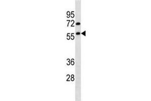 TRIM13 antibody western blot analysis in HepG2 lysate. (TRIM13 Antikörper  (AA 61-90))