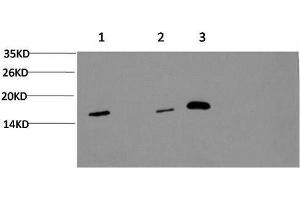 Western Blot analysis of 1) Hela, 2) 3T3, 3) Rat brain using MAP1LC3A Monoclonal Antibody at dilution of 1:1000. (MAP1LC3A Antikörper)