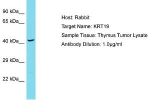 Host: Rabbit Target Name: KRT19 Sample Type: Thymus Tumor lysates Antibody Dilution: 1. (Cytokeratin 19 Antikörper  (Middle Region))