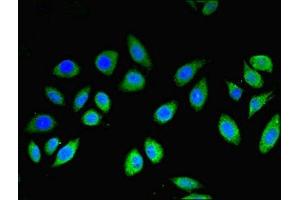 Immunofluorescent analysis of A549 cells using ABIN7159245 at dilution of 1:100 and Alexa Fluor 488-congugated AffiniPure Goat Anti-Rabbit IgG(H+L) (MLANA Antikörper  (AA 48-118))