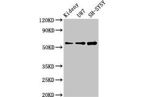 Western Blot Positive WB detected in: Mouse kidney tissue, U87 whole cell lysate, SH-SY5Y whole cell lysate All lanes: KCNAB1 antibody at 3. (KCNAB1 Antikörper  (AA 287-401))